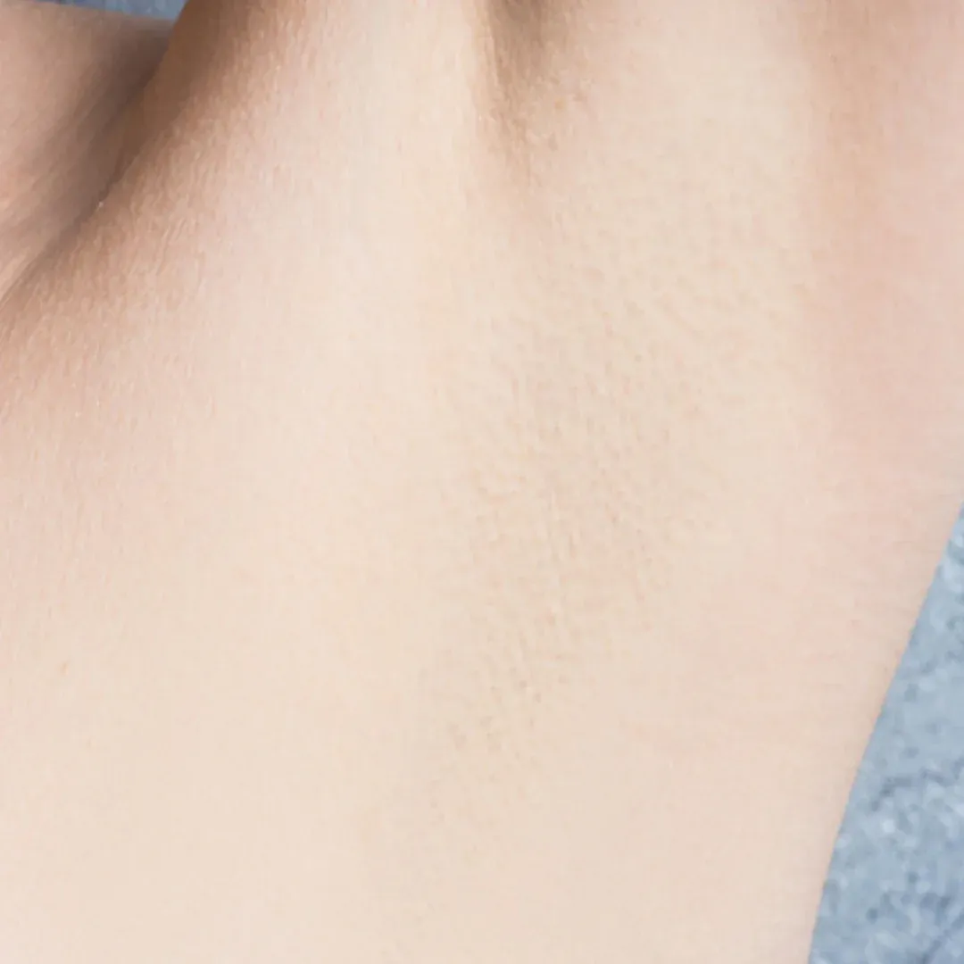 https://cdn.shoprose.net/image/225ca8823eb6d04dccfe65af8b2945770d8a95bb.webp Hair Removal Formula (8).png__PID:46389fe7-ca0b-4157-8ff4-dc783574d882