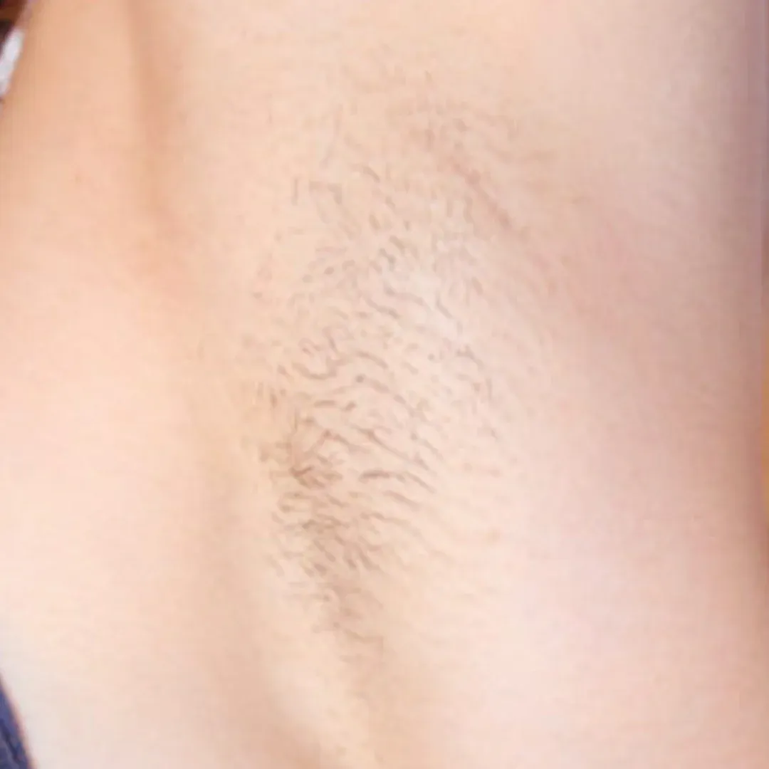https://cdn.shoprose.net/image/dd01f5ac73f7bfdfd8295bb2051ef2624f7b9900.webp Hair Removal Formula (7).png__PID:389fe7ca-0b51-478f-b4dc-783574d88240