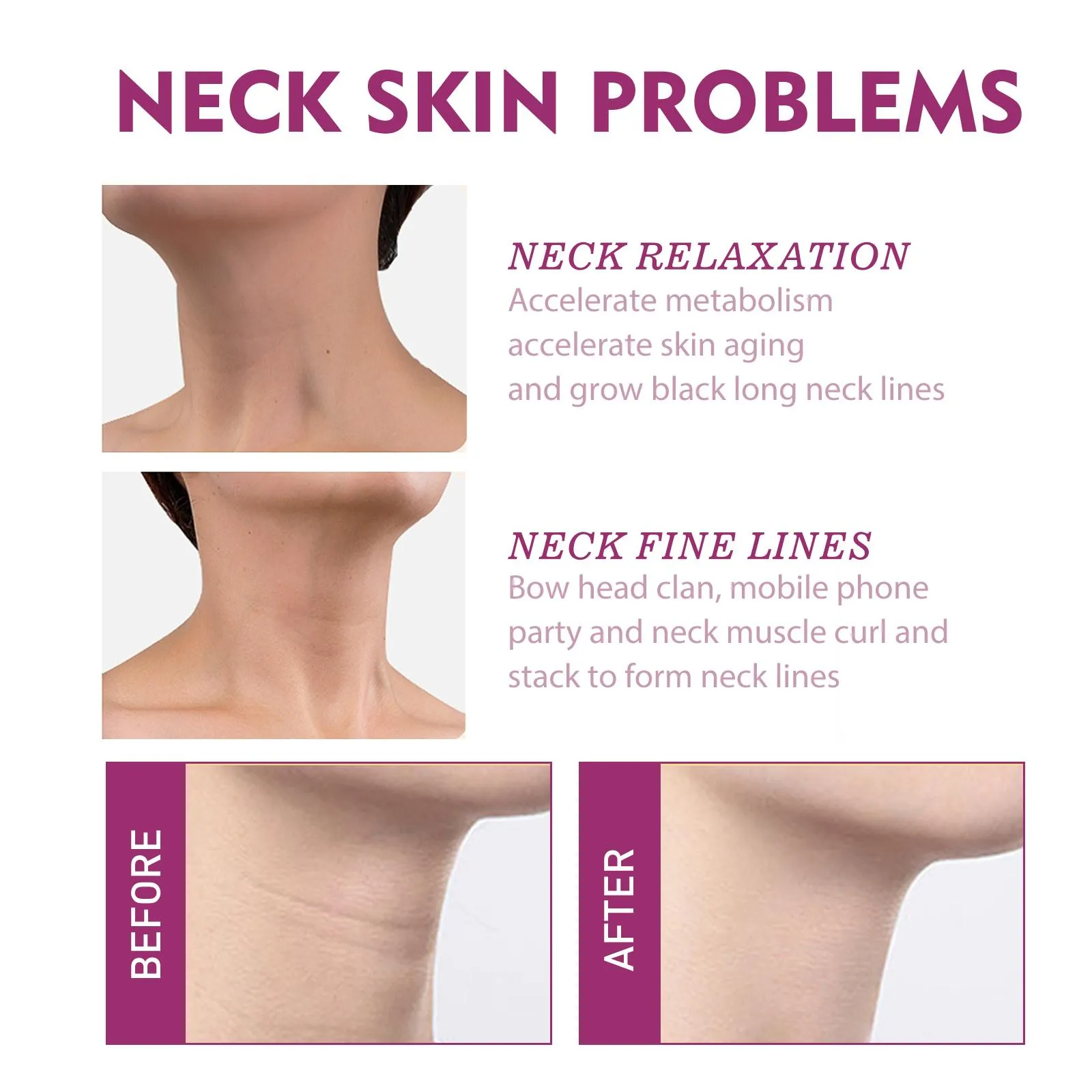 Hydrolyzed Collagen Neck Cream Hydrolyzed Collagen Neck Cream